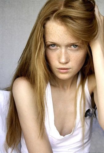 freckled girl