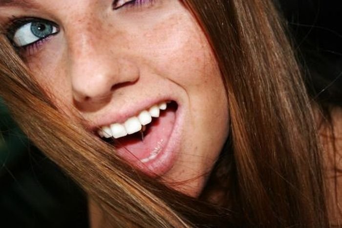 freckled girl