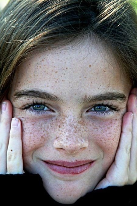 freckled girl
