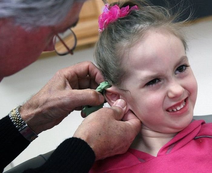 little girl gets new ear and cochlear implant