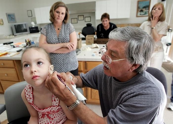 little girl gets new ear and cochlear implant