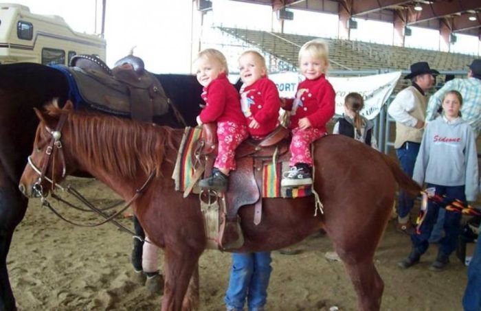 Macey and Mackenzie Garrison, conjoined twins