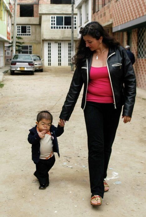 Edward Niño Hernández, world's shortest man