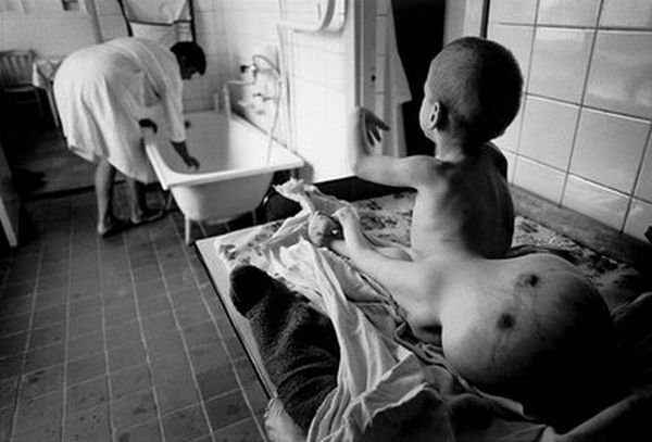 Chernobyl Legacy reportage by Paul Fusco