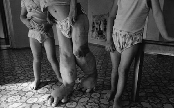 Chernobyl Legacy reportage by Paul Fusco