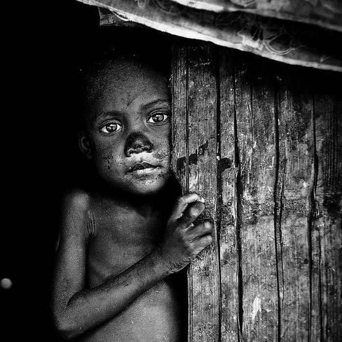 Faces of Poverty