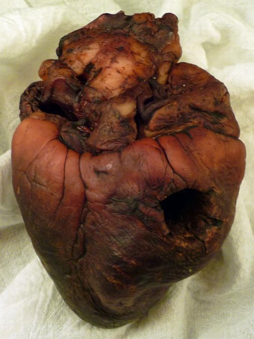 Mummified heart  of the vampire Auguste Delagrange on eBay