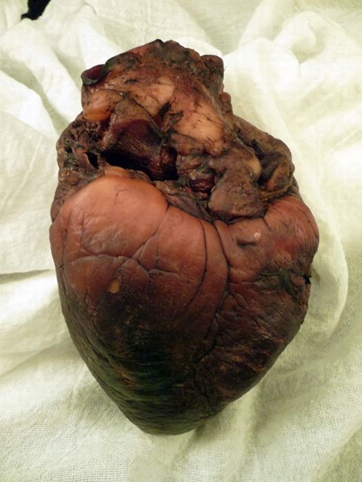 Mummified heart  of the vampire Auguste Delagrange on eBay