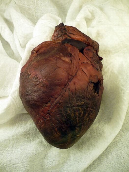 Mummified heart  of the vampire Auguste Delagrange on eBay