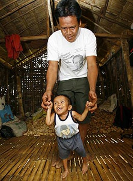 Jun Rey Balawing, world's smallest man, Philippines