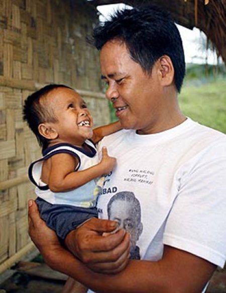 Jun Rey Balawing, world's smallest man, Philippines