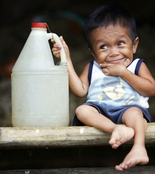 Jun Rey Balawing, world's smallest man, Philippines