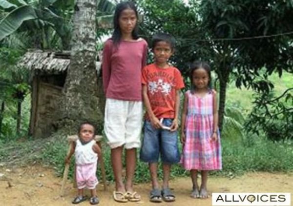 Jun Rey Balawing, world's smallest man, Philippines