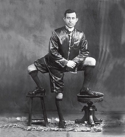 History: Francesco Lentini, man with three legs, Rosolini, Italy