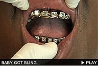 TopRq.com search results: teeth holder jewelry around the world