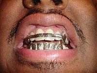 TopRq.com search results: teeth holder jewelry around the world