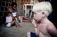 People & Humanity: Family of black Brazilians had three albinos, Pernambuco, Brazilia