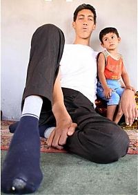 People & Humanity: Sultan Kosen, Tallest man in the world, 2 meters 47 centimeters, Turkey