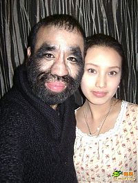 People & Humanity: The most hairy man, China