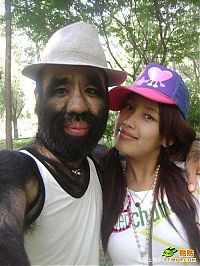 People & Humanity: The most hairy man, China
