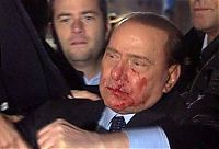 TopRq.com search results: Silvio Berlusconi, Massimo Tartaglia hit and intentionally injure Prime Minister of Italy, Sunday, Milan, Italy