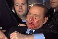 People & Humanity: Silvio Berlusconi, Massimo Tartaglia hit and intentionally injure Prime Minister of Italy, Sunday, Milan, Italy