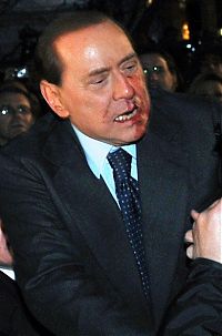 TopRq.com search results: Silvio Berlusconi, Massimo Tartaglia hit and intentionally injure Prime Minister of Italy, Sunday, Milan, Italy