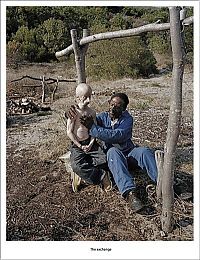 People & Humanity: Leon Botha with rare disease Progeria