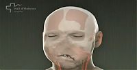 TopRq.com search results: World's first full face transplant, Spain