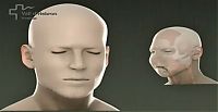 TopRq.com search results: World's first full face transplant, Spain