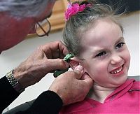 People & Humanity: little girl gets new ear and cochlear implant