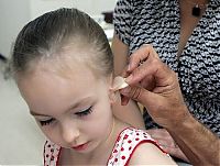 People & Humanity: little girl gets new ear and cochlear implant