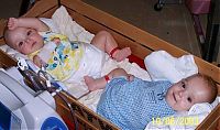 TopRq.com search results: Macey and Mackenzie Garrison, conjoined twins