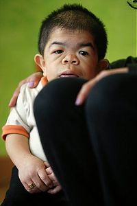 People & Humanity: Edward Niño Hernández, world's shortest man