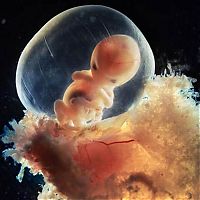 TopRq.com search results: human embryogenesis, fertilization and fetus development