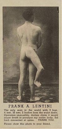 TopRq.com search results: History: Francesco Lentini, man with three legs, Rosolini, Italy
