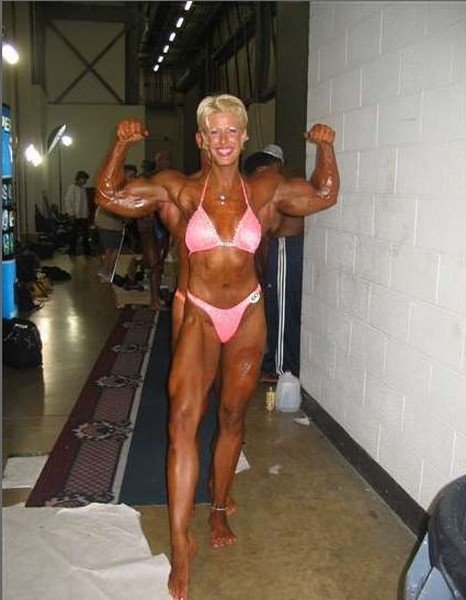 Barbie Guerra lost her hands from electric shock, but she still does a bodybuilding