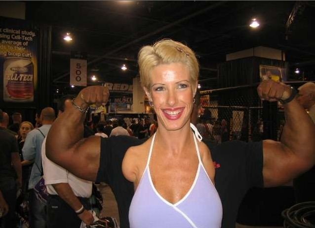 Barbie Guerra lost her hands from electric shock, but she still does a bodybuilding