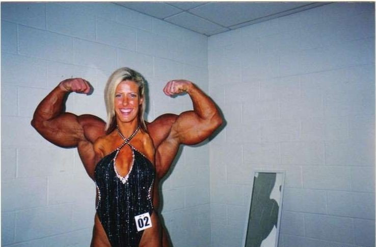 Barbie Guerra lost her hands from electric shock, but she still does a bodybuilding